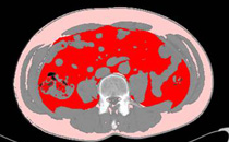 内臓脂肪の図：2画像