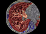 X線CT（コンピュータ断層）撮影装置（64マルチスライスCT1台）画像3